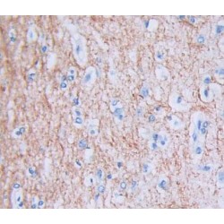 Pseudouridylate Synthase 1 (PUS1) Antibody