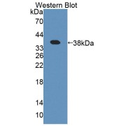 Western blot analysis of the recombinant protein.