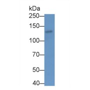 Western blot analysis of HS5 cell lysates, using Rabbit Anti-Human NTXI Antibody (3 µg/ml) and HRP-conjugated Goat Anti-Rabbit antibody (<a href="https://www.abbexa.com/index.php?route=product/search&amp;search=abx400043" target="_blank">abx400043</a>, 0.2 µg/ml).