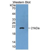 Western blot analysis of the recombinant protein.