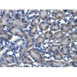 Proline Dehydrogenase, Mitochondrial (PRODH) Antibody