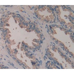 Protein-Arginine Deiminase Type 1 (PADI1) Antibody