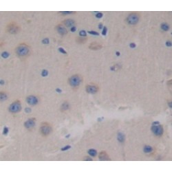 Succinate Dehydrogenase Complex Subunit C (SDHC) Antibody