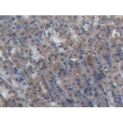 Pyruvate Dehydrogenase Phosphatase 2 (PDP2) Antibody