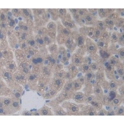 Pyruvate Dehydrogenase Phosphatase 2 (PDP2) Antibody