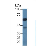 Western blot analysis of Pig Cerebrum lysate, using Human PPP1Ca Antibody (1 µg/ml) and HRP-conjugated Goat Anti-Rabbit antibody (<a href="https://www.abbexa.com/index.php?route=product/search&amp;search=abx400043" target="_blank">abx400043</a>, 0.2 µg/ml).