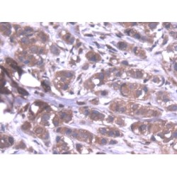 Protein Phosphatase 1, Catalytic Subunit Alpha Isoform (PPP1Ca) Antibody