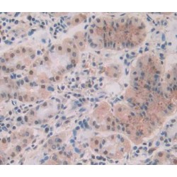 Protein Phosphatase 1, Catalytic Subunit Alpha Isoform (PPP1Ca) Antibody