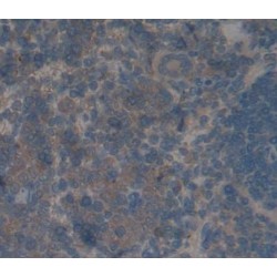 Protein Phosphatase 1, Regulatory Subunit 15A (PPP1R15A) Antibody