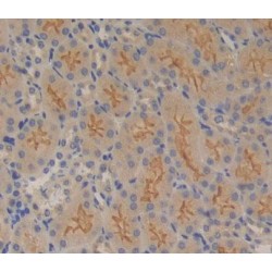 Protein Tyrosine Phosphatase Receptor Type B (PTPRB) Antibody