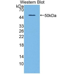 Aldehyde Dehydrogenase 1 Family, Member A2 (ALDH1A2) Antibody