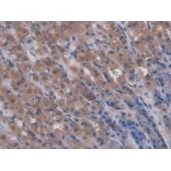 Receptor Interacting Serine Threonine Kinase 1 (RIPK1) Antibody