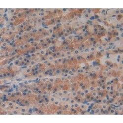 Receptor Interacting Serine Threonine Kinase 1 (RIPK1) Antibody