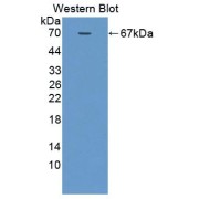 Western blot analysis of the recombinant protein.