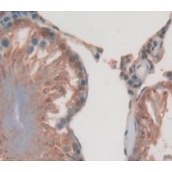 Solute Carrier Family 30, Member 3 (SLC30A3) Antibody