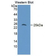 Western blot analysis of recombinant Rat Androgen Receptor.