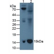 Western blot analysis of (1) Rat Serum Tissue, and (2) Rat Spleen Tissue, using Rabbit Anti-Rat b2M Antibody (1 µg/ml) and HRP-conjugated Rabbit Anti-Mouse antibody (<a href="https://www.abbexa.com/index.php?route=product/search&amp;search=abx400002" target="_blank">abx400002</a>, 1:5000 dilution).