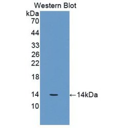 Beta-2-Microglobulin (B2M) Antibody