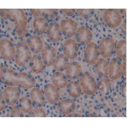 Beta-2-Microglobulin (B2M) Antibody