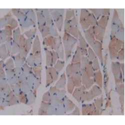 Beta-2-Microglobulin (B2M) Antibody