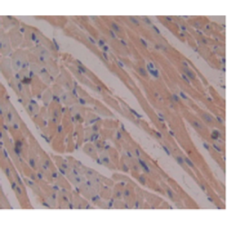 Beta-2-Microglobulin (B2M) Antibody