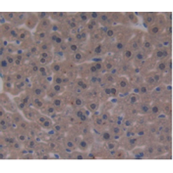 Beta-2-Microglobulin (B2M) Antibody