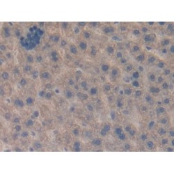 Connective Tissue Growth Factor (CCN2) Antibody