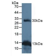 Western blot analysis of Human Leukocyte Cells.