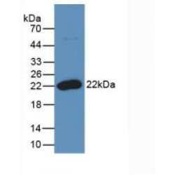 Tumor Necrosis Factor Ligand Superfamily Member 11 (TNFSF11) Antibody