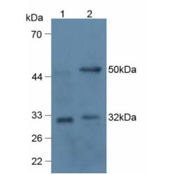 Tumor Necrosis Factor Ligand Superfamily Member 11 (TNFSF11) Antibody