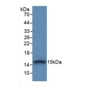 Western blot analysis of recombinant Human FGFR1.