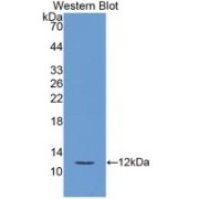 Western blot analysis of recombinant Human uPAR.