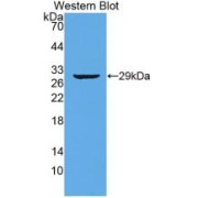 Western blot analysis of recombinant Human TTN.