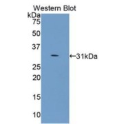 Western blot analysis of recombinant Human COL4a5.