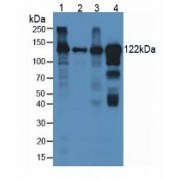 Western blot analysis of (1) Rat Lung Tissue, (2) Rat Brain Tissue, (3) Rat Liver Tissue, and (4) Rat Serum, using Rabbit anti-Rat Ceruloplasmin Antibody (3 µg/ml) and and HRP-conjugated Rabbit Anti-Mouse antibody (<a href="https://www.abbexa.com/index.php?route=product/search&amp;search=abx400002" target="_blank">abx400002</a>, 1:5000 dilution).