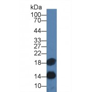 Western blot analysis of Human Serum, using Human SAA Antibody (3 µg/ml) and HRP-conjugated Goat Anti-Mouse antibody (<a href="https://www.abbexa.com/index.php?route=product/search&amp;search=abx400001" target="_blank">abx400001</a>, 0.2 µg/ml).