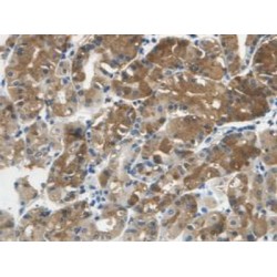 Cystatin C (CST3) Antibody