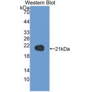 Western blot analysis of the recombinant protein.