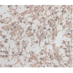 Gamma-Enolase (ENO2) Antibody