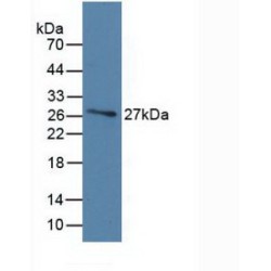 Vitamin D Binding Protein (DBP) Antibody