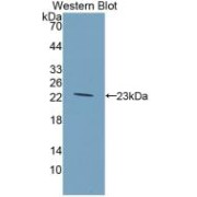 Western blot analysis of recombinant Rat GKRP.