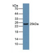 Western blot analysis of Human Jurkat Cells, using Rabbit Anti-Human HMG1 Antibody (3 µg/ml) and HRP-conjugated Rabbit Anti-Mouse antibody (<a href="https://www.abbexa.com/index.php?route=product/search&amp;search=abx400002" target="_blank">abx400002</a>, 1:5000 dilution).