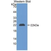 Western blot analysis of recombinant Rat NGAL.