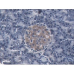 Neutrophil Gelatinase Associated Lipocalin / NGAL (LCN2) Antibody