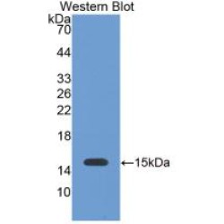 Galectin 1 (LGALS1) Antibody