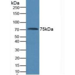 Muellerian-Inhibiting Factor (AMH) Antibody