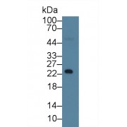 Western blot analysis of Human Serum, using Human RBP4 Antibody (1 µg/ml) and HRP-conjugated Goat Anti-Mouse antibody (<a href="https://www.abbexa.com/index.php?route=product/search&amp;search=abx400001" target="_blank">abx400001</a>, 0.2 µg/ml).