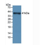 Western blot analysis of recombinant Rat NPHN.