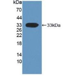 Dickkopf-Related Protein 1 (DKK1) Antibody