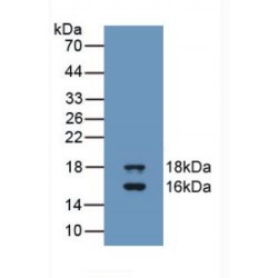 Growth Differentiation Factor 3 (GDF3) Antibody